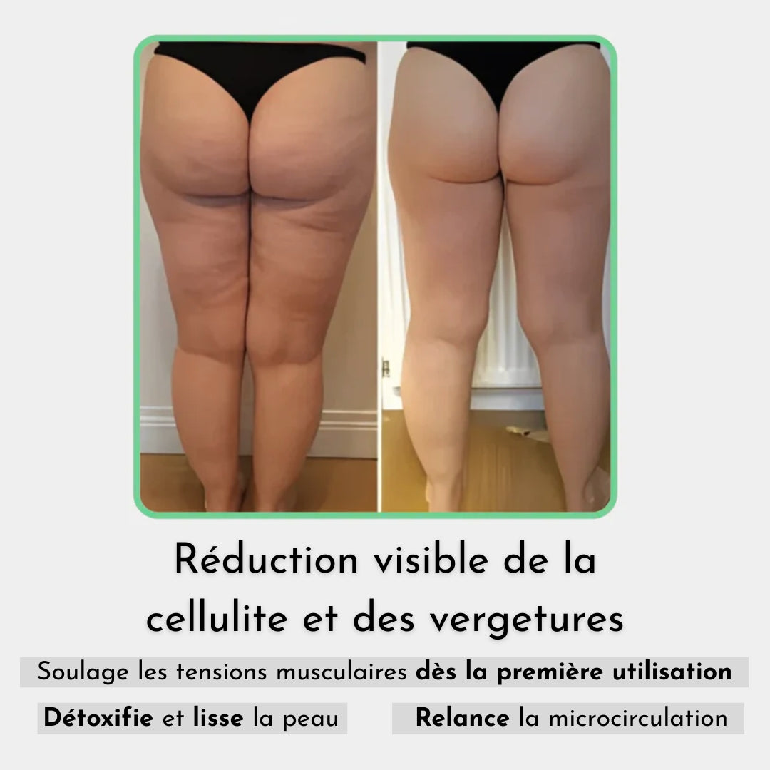 Heymily™ Masseur Anti Cellulite