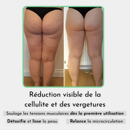 Heymily™ Masseur Anti Cellulite